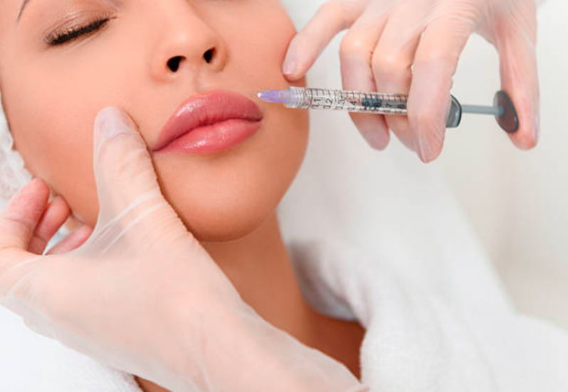 Clínica de Aplicação de Botox na Boca Santa Cruz - Aplicação de Botox nos Lábios