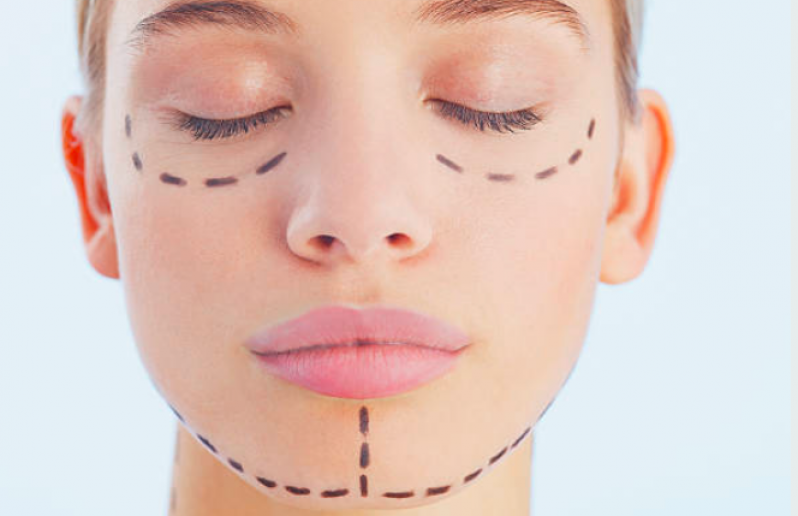 Clínica para Harmonização Facial Mulher Cooperativa - Harmonização Facial