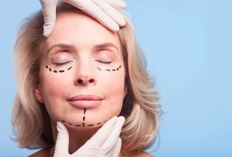 Clínica para Harmonização Facial Olheiras Capivari - Harmonização Facial Mulher