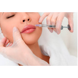 clínica de aplicação de botox nos lábios Cinco