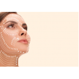 clínica para harmonização facial com jato de plasma Cerâmica
