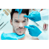 clínica para harmonização facial masculina Bairro Campestre